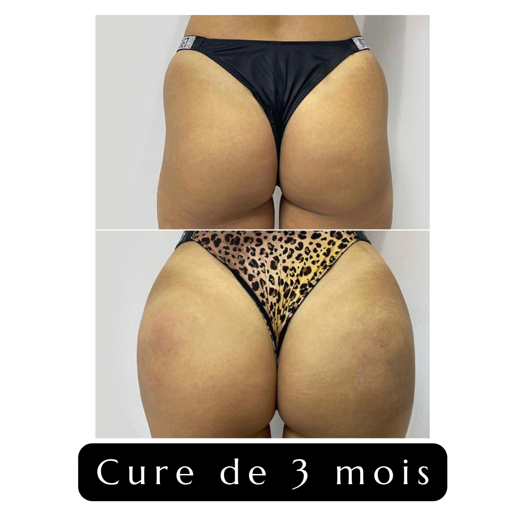 Volume-Express Gummies für Po & Hüften