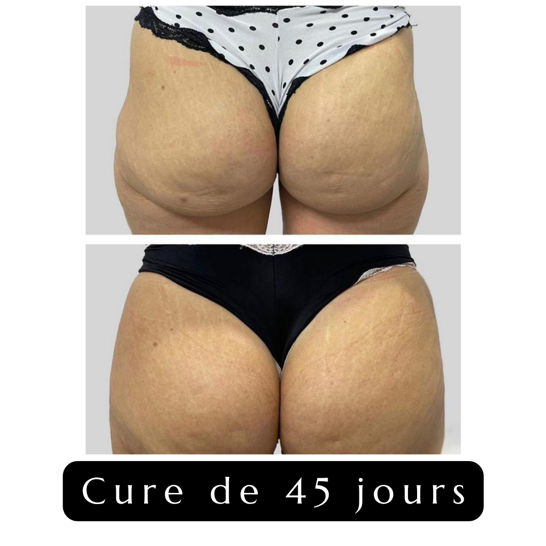 Volume-Express Gummies für Po & Hüften